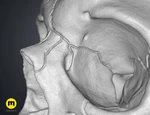 Modelo 3d de Human skull para impresoras 3d