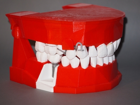  Dental demonstration model / modèle de démonstration dentaire  3d model for 3d printers