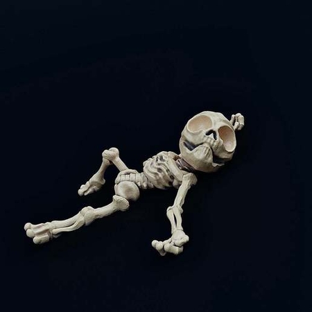 Skeletal Zeta-Reticulan Casualty