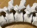  Articulating lumbar vertebrae  3d model for 3d printers